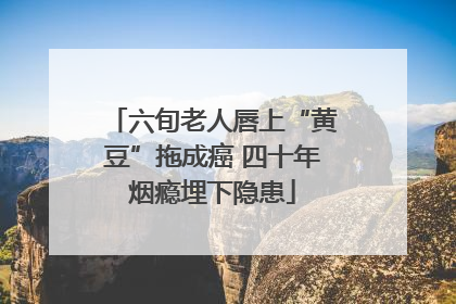 六旬老人唇上“黄豆”拖成癌 四十年烟瘾埋下隐患